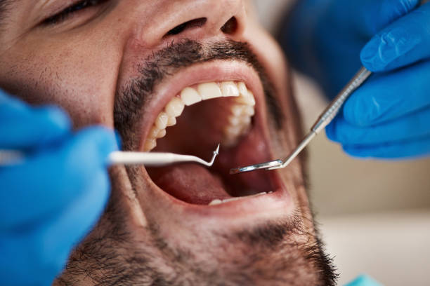 Best Tooth Infection Emergency Dentist  in Conyers, GA