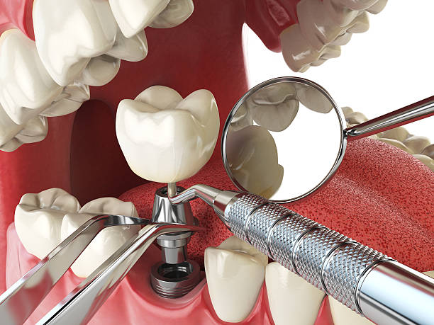 Best Emergency Dental Filling Replacement  in Conyers, GA